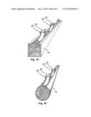 DEVICE FOR SUCTIONING OFF WASTE PRODUCTS FROM A PRODUCTION MACHINE diagram and image