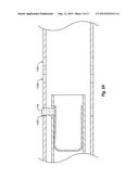 REMOVABLE VEHICLE TOP LIFT SYSTEM diagram and image