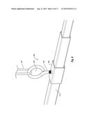 REMOVABLE VEHICLE TOP LIFT SYSTEM diagram and image