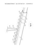 REMOVABLE VEHICLE TOP LIFT SYSTEM diagram and image