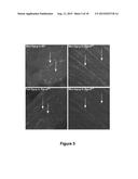 Antisense Polynucleotides to Induce Exon Skipping and Methods of Treating     Dystrophies diagram and image