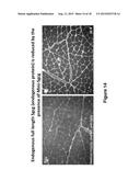 Antisense Polynucleotides to Induce Exon Skipping and Methods of Treating     Dystrophies diagram and image