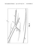 METHOD FOR INJECTING A FLUID INTO AN ARTIFIICIAL VENOUS STRUCTURE diagram and image