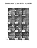 METHODS AND SYSTEMS FOR DETERMINING VOLUMETRIC PROPERTIES OF A TISSUE diagram and image