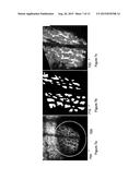 METHODS AND SYSTEMS FOR DETERMINING VOLUMETRIC PROPERTIES OF A TISSUE diagram and image