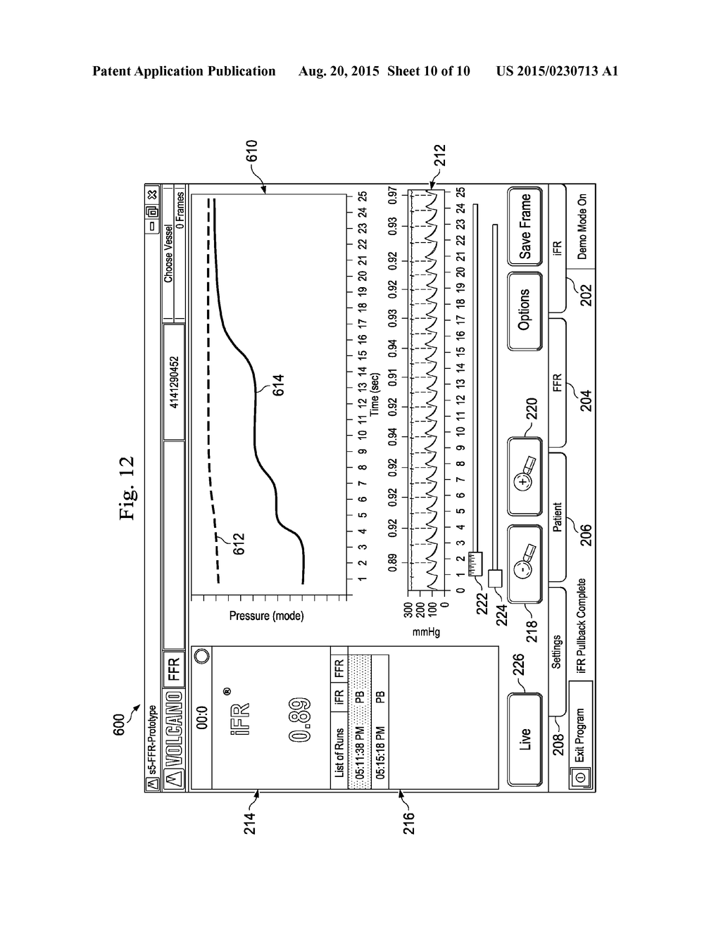 Devices, Systems, and Methods and Associated Display Screens for     Assessment of Vessels - diagram, schematic, and image 11