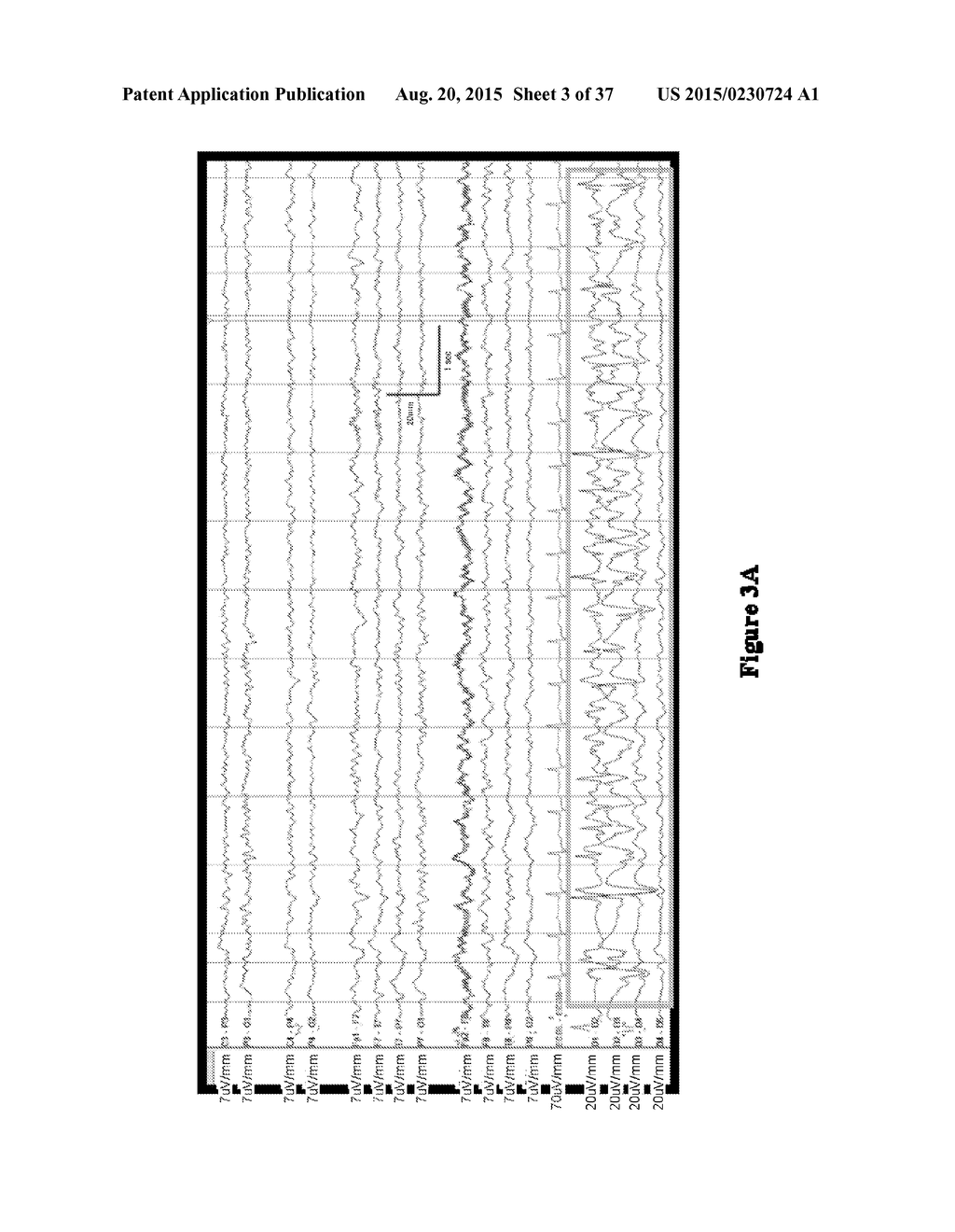 SYSTEMS AND METHODS FOR MEASURING BRAIN ACTIVITY - diagram, schematic, and image 04