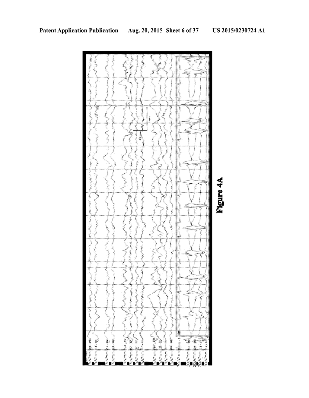 SYSTEMS AND METHODS FOR MEASURING BRAIN ACTIVITY - diagram, schematic, and image 07