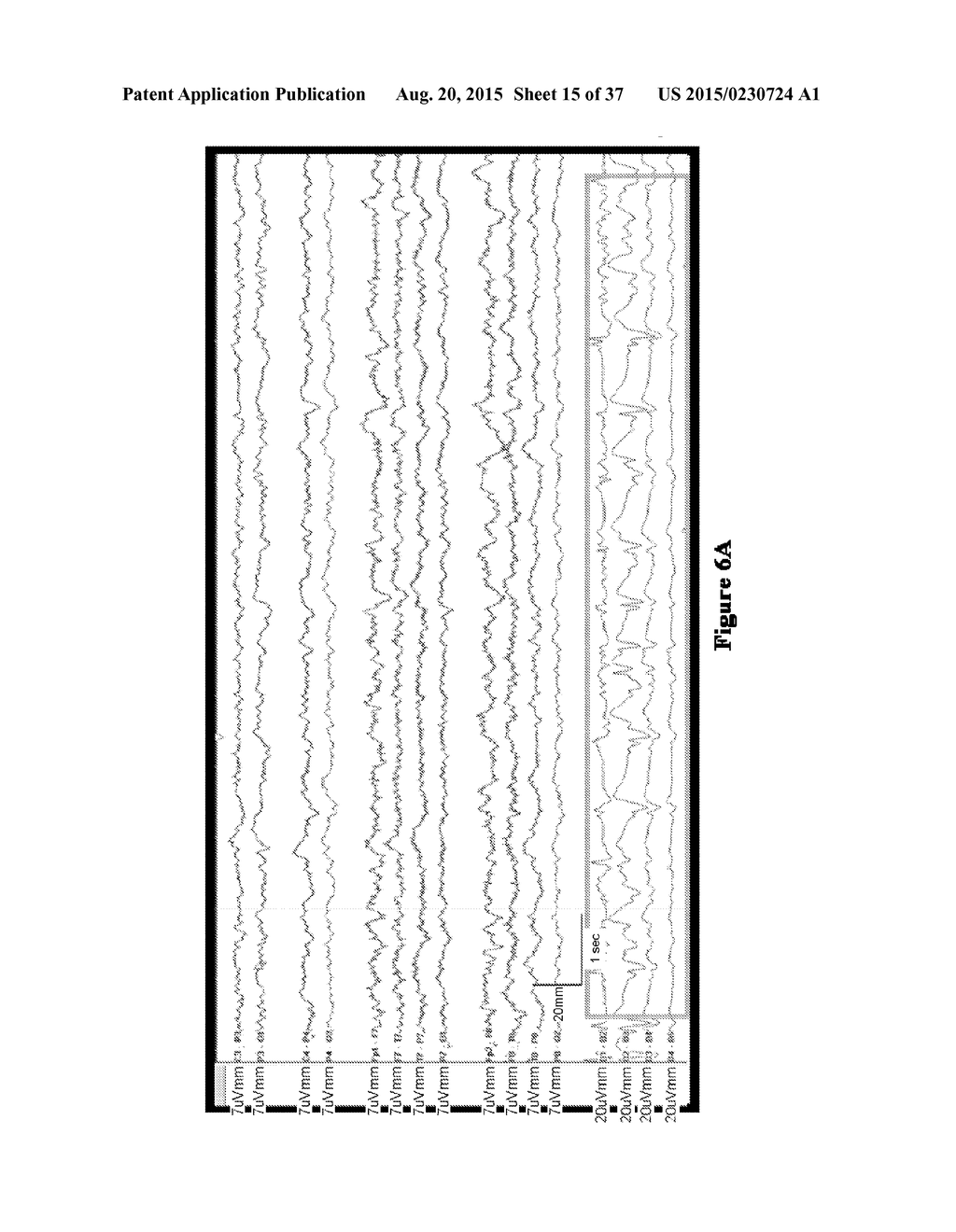 SYSTEMS AND METHODS FOR MEASURING BRAIN ACTIVITY - diagram, schematic, and image 16