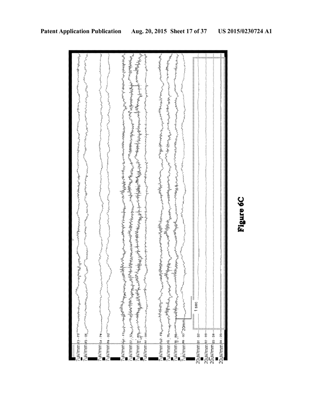 SYSTEMS AND METHODS FOR MEASURING BRAIN ACTIVITY - diagram, schematic, and image 18