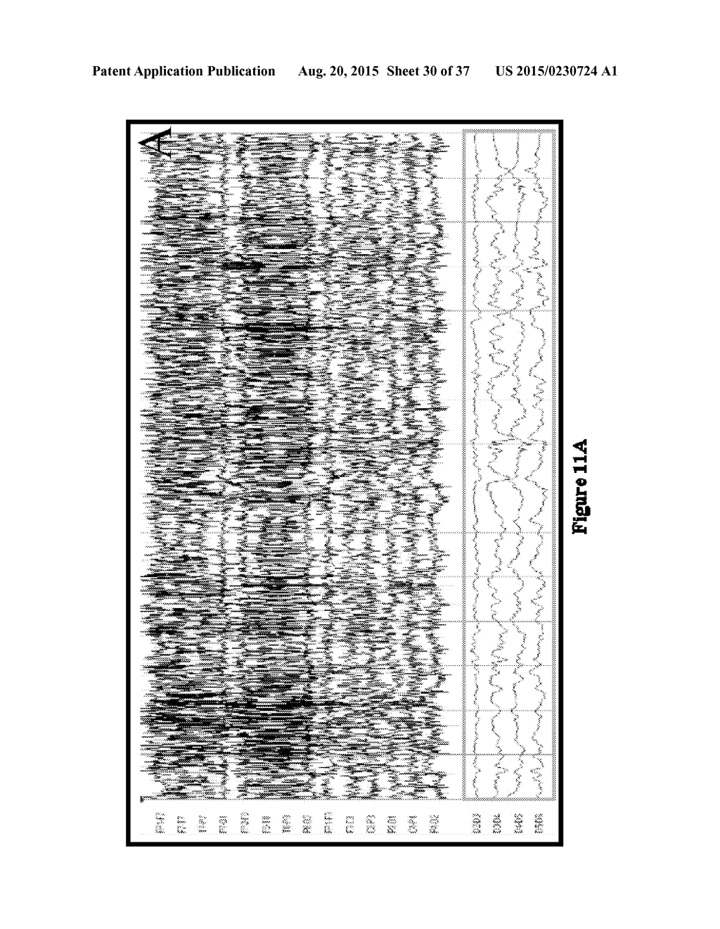 SYSTEMS AND METHODS FOR MEASURING BRAIN ACTIVITY - diagram, schematic, and image 31