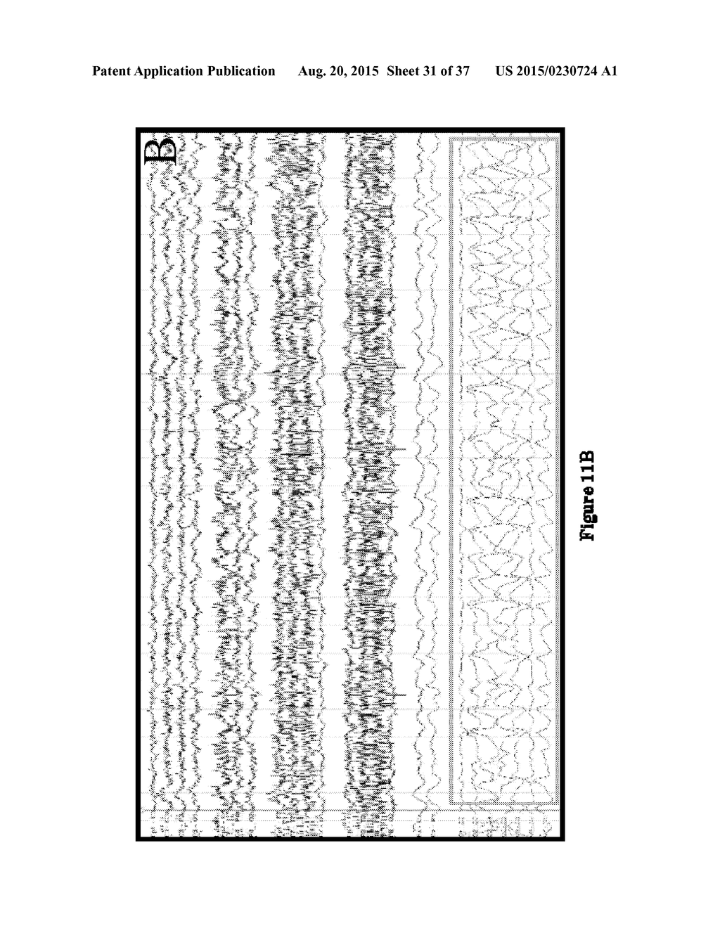 SYSTEMS AND METHODS FOR MEASURING BRAIN ACTIVITY - diagram, schematic, and image 32