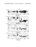 DETERMINING PHYSIOLOGICAL CHARACTERISTICS FROM SENSOR SIGNALS INCLUDING     MOTION ARTIFACTS diagram and image