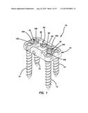 Lateral plate diagram and image