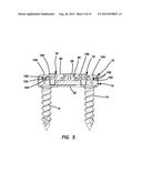 Lateral plate diagram and image