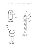 Lateral plate diagram and image