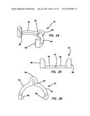 Lateral plate diagram and image