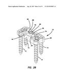 Lateral plate diagram and image