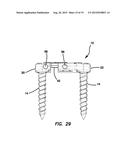 Lateral plate diagram and image