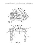 Lateral plate diagram and image