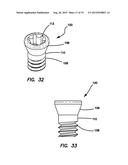 Lateral plate diagram and image