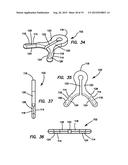 Lateral plate diagram and image