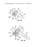 Lateral plate diagram and image