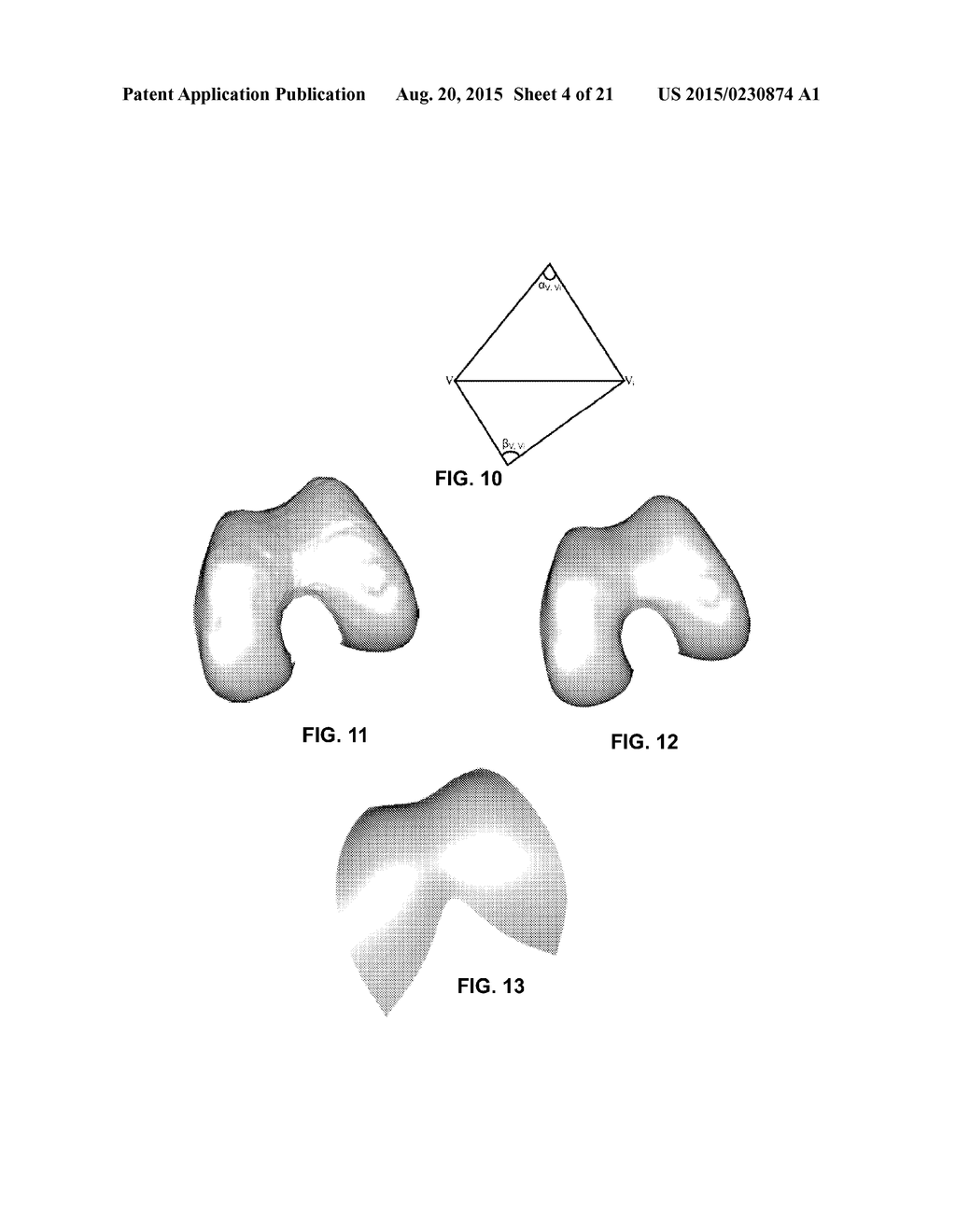 PERSONALIZED ORTHOPEDIC IMPLANT CAD MODEL GENERATION - diagram, schematic, and image 05