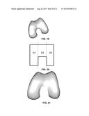 PERSONALIZED ORTHOPEDIC IMPLANT CAD MODEL GENERATION diagram and image