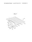 Universal Bioabsorbable Nasal Implant Kit diagram and image