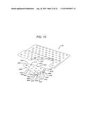 Universal Bioabsorbable Nasal Implant Kit diagram and image