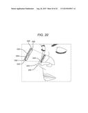 Universal Bioabsorbable Nasal Implant Kit diagram and image