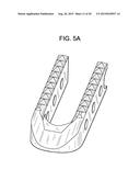 Composite Vertebral Spacers and Instrument diagram and image