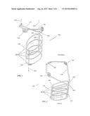 Y-LOCK TRACHEAL STENT SYSTEM AND METOD OF USE diagram and image