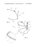 Y-LOCK TRACHEAL STENT SYSTEM AND METOD OF USE diagram and image