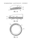 ENDOVASCULAR GRAFT JOINT AND METHOD FOR MANUFACTURE diagram and image