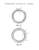 ENDOVASCULAR GRAFT JOINT AND METHOD FOR MANUFACTURE diagram and image