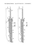 ENDOVASCULAR GRAFT JOINT AND METHOD FOR MANUFACTURE diagram and image