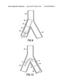 STENT/GRAFT ASSEMBLY diagram and image