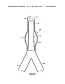 STENT/GRAFT ASSEMBLY diagram and image