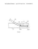 STENT/GRAFT ASSEMBLY diagram and image