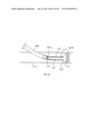 STENT/GRAFT ASSEMBLY diagram and image