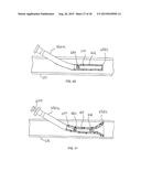 STENT/GRAFT ASSEMBLY diagram and image