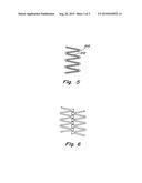 CONTROLLED FRACTURE CONNECTIONS FOR STENTS diagram and image