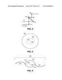 INTRAOCULAR LENS diagram and image