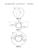 INTRAOCULAR LENS diagram and image