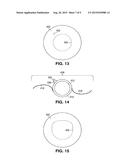 INTRAOCULAR LENS diagram and image