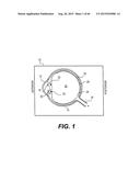 MODULAR INTRAOCULAR LENS DESIGNS, TOOLS AND METHODS diagram and image