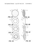 MODULAR INTRAOCULAR LENS DESIGNS, TOOLS AND METHODS diagram and image