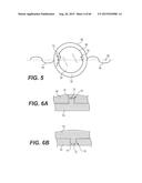 MODULAR INTRAOCULAR LENS DESIGNS, TOOLS AND METHODS diagram and image